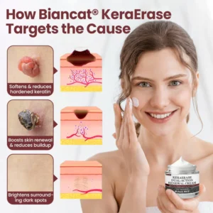 Biancat®KeraErase Dual-Action Renewal Cream