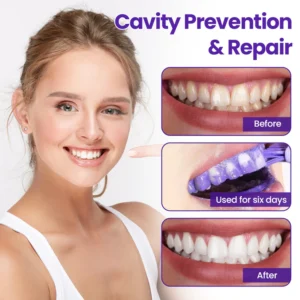 Biancat® OralMatrix Teeth Regeneration Mineral Powder