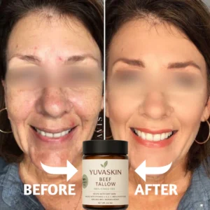 YuvaSkin™ Beef Tallow Cream