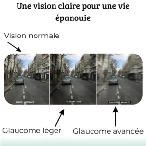 VISION ENHANCE ROLLER: Clarity - Give Your Eyes New Vitality