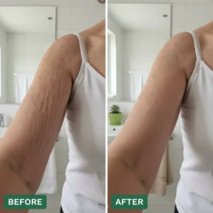 Crepey Skin Repair Cream