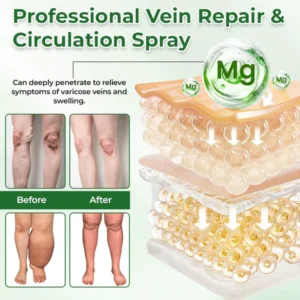 VeinFlex Magnesium Spray for Vein Relief