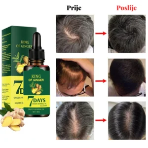GINGER SERUM AGAINST HAIR LOSS