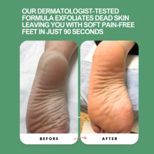 Peele – Instant Foot Peeling Spray