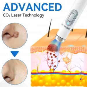 𝐉𝐚𝐬𝐬𝐞𝐞𝐦® 𝐍𝐨𝐧-𝐈𝐧𝐯𝐚𝐬𝐢𝐯𝐞 𝐌𝐨𝐥𝐞 & 𝐖𝐚𝐫𝐭 𝐋𝐚𝐬𝐞𝐫 𝐑𝐞𝐦𝐨𝐯𝐚𝐥 𝐏𝐞𝐧