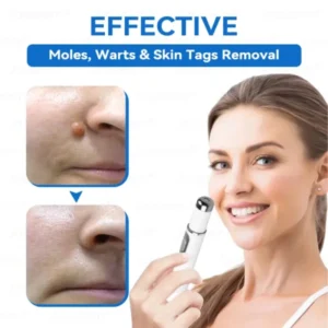 𝐉𝐚𝐬𝐬𝐞𝐞𝐦® 𝐍𝐨𝐧-𝐈𝐧𝐯𝐚𝐬𝐢𝐯𝐞 𝐌𝐨𝐥𝐞 & 𝐖𝐚𝐫𝐭 𝐋𝐚𝐬𝐞𝐫 𝐑𝐞𝐦𝐨𝐯𝐚𝐥 𝐏𝐞𝐧