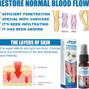 Goodbye Veins - Varicose Veins Spray