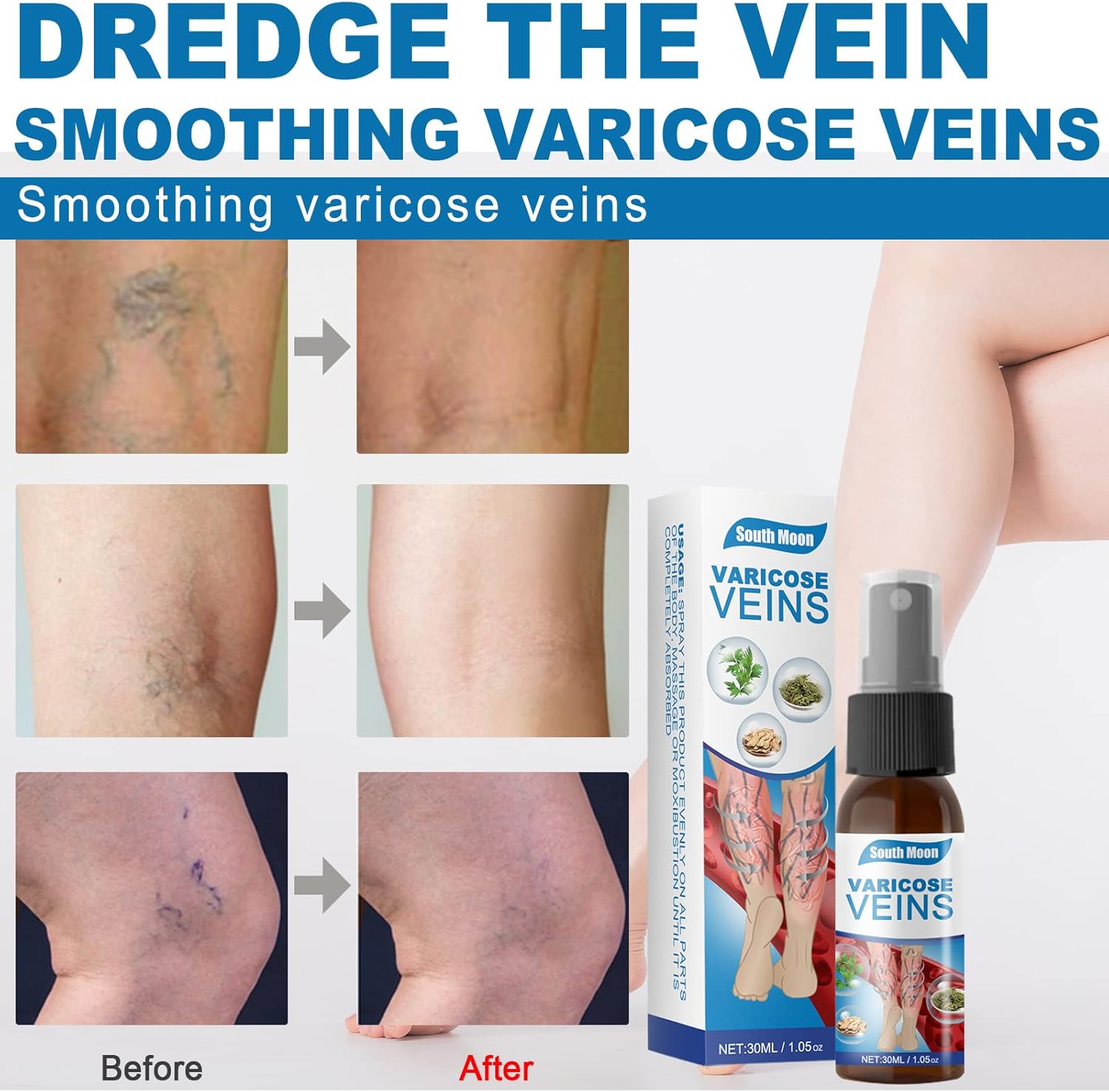Goodbye Veins - Varicose Veins Spray
