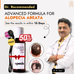 Advanced Formula For Alopecia Treatment