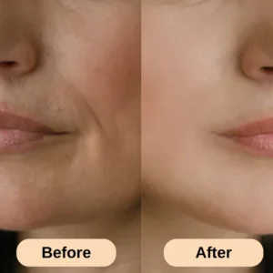 ReviaSkin™ Silicone Scar Stick