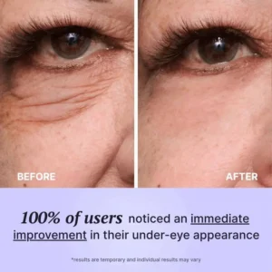 Perfect FirmX - Instant Eye Tightener