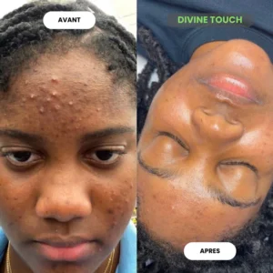 The Best Turmeric Cotton