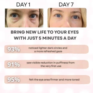 Eyeluma™ – The Korean Skincare Ritual That Awakens Your Eyes