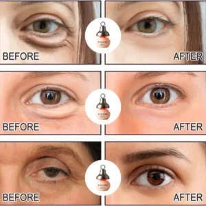 Eyeluma™ – The Korean Skincare Ritual That Awakens Your Eyes