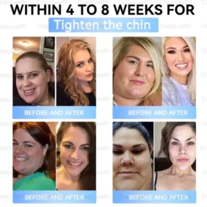 Slimming Patch with Collagen + Matrixyl 3000