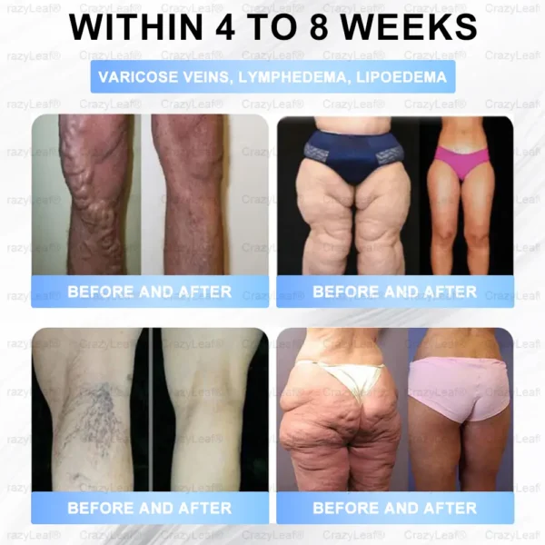 Slimming Patch with Collagen + Matrixyl 3000