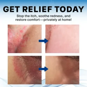 Fivfivgo® Scrotum Itchy Treatment Cream