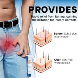 Fivfivgo® Scrotum Itchy Treatment Cream