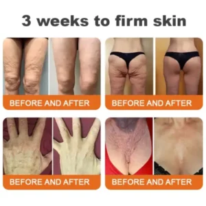 Firming gel for sagging skin 