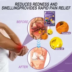 HONXI™ Turmeric and Emu Oil Anti-Inflammatory Slimming Foot Soak Pearls