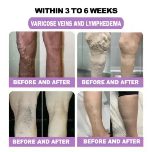 HONXI™ Turmeric and Emu Oil Anti-Inflammatory Slimming Foot Soak Pearls