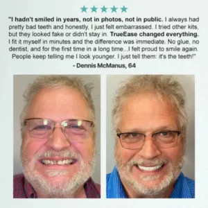 NESLEMY™ 𝗔𝗱𝘃𝗮𝗻𝗰𝗲𝗱 𝗖𝘂𝘀𝘁𝗼𝗺𝗶𝘇𝗲𝗱 𝗙𝘂𝗹𝗹 𝗗𝗲𝗻𝘁𝘂𝗿𝗲 𝗦𝗲𝘁