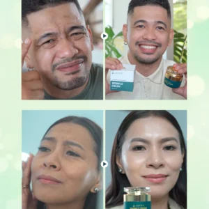 Abera Wrinkle Cream – Erases Wrinkles
