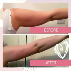 Arm Shaping Sleeves with Posture Support – Lightweight and Stretchy Design