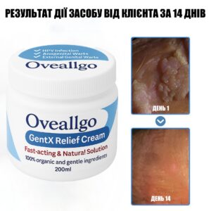 Oveallgo GentX Relief Cream – A universal remedy for skin health