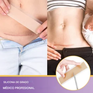 Oveallgo® RejuveSkin Tape (1.5 Meters)