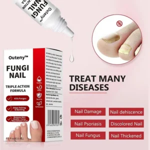 Extra Strength Antifungal Nail Solution – Fast Clear & Repair Formula