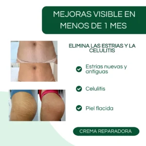 skin barrier repair cream