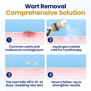 Timilk ChillErase Bump Renewal Spray