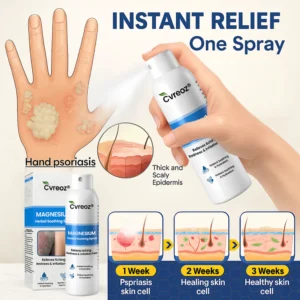 Cvreoz® Magnesium Herbal Psoriasis Spray