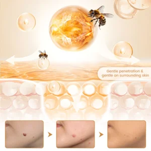 Biancat BeeVenom Wart Drop Serum bottle