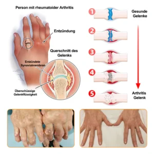 bee venom lithospermum comfort cream