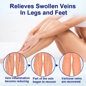 Herbal Varicose Vein Relief Spray – MicroMist Absorption Formula