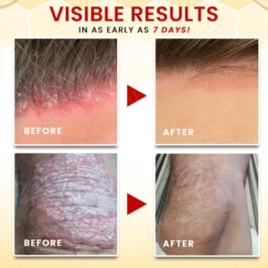 gentle bee essence formula