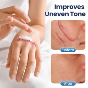 uneven skin texture care