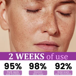 Intensive Hyperpigmentation Treatment Serum