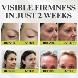 AEXZR® Botox & Vita-A Retinol Shot Wrinkle - Lift Tightening Cream