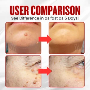 neutral comfort patch for everyday use