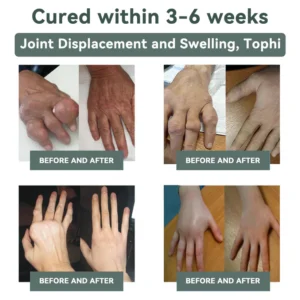 Cvreoz®Nerve Repair &Pain Relief Magnesium Cream