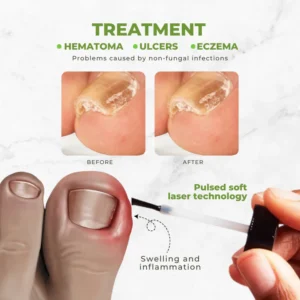 Bee Venom Nail Repair Oil – Strengthening & Revitalizing Formula