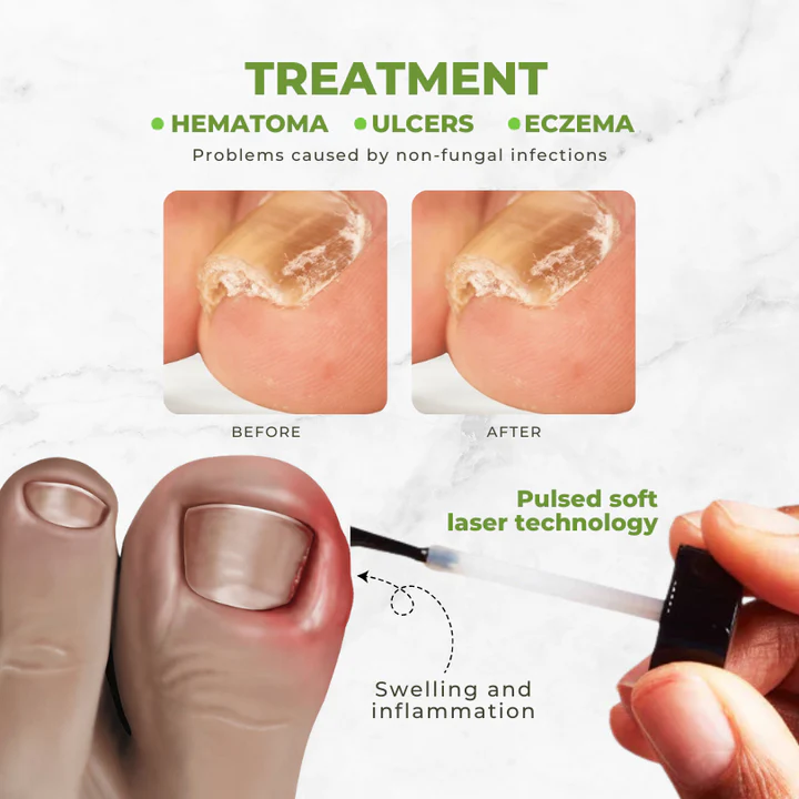 Bee Venom Nail Repair Oil – Strengthening & Revitalizing Formula