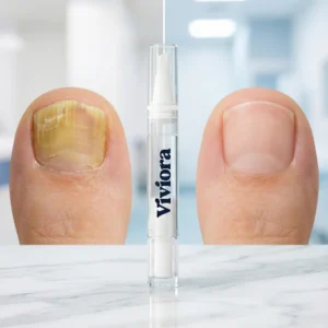 Antifungal Nail Repair Pen – Fast Clear & Strengthening Formula