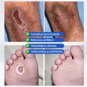 hydrating body cream for dry skin