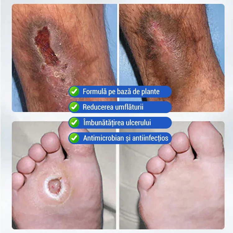 hydrating body cream for dry skin