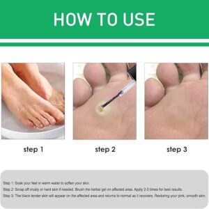 JAYSUING Effective Skin Corns Wart Remover Liquid Serum 1c1e21