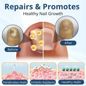 healthy nail appearance care